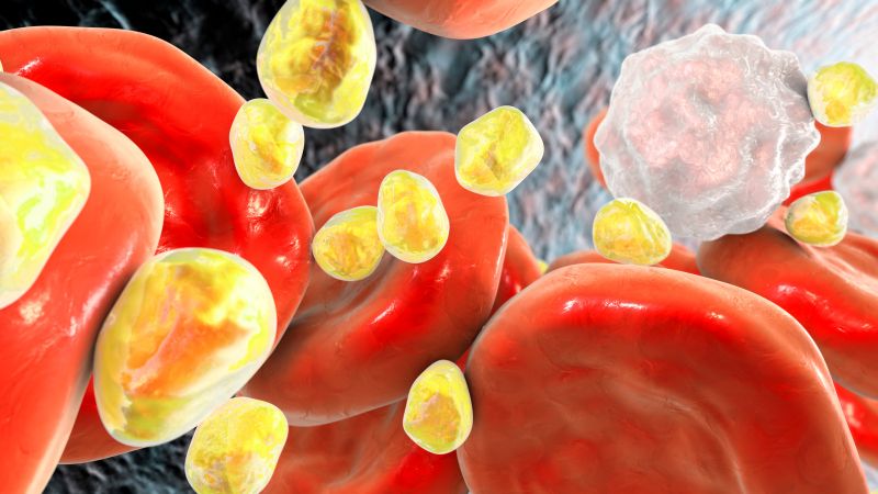 Rối loạn lipid máu là tình trạng mất cân bằng thành phần chất béo trong máu