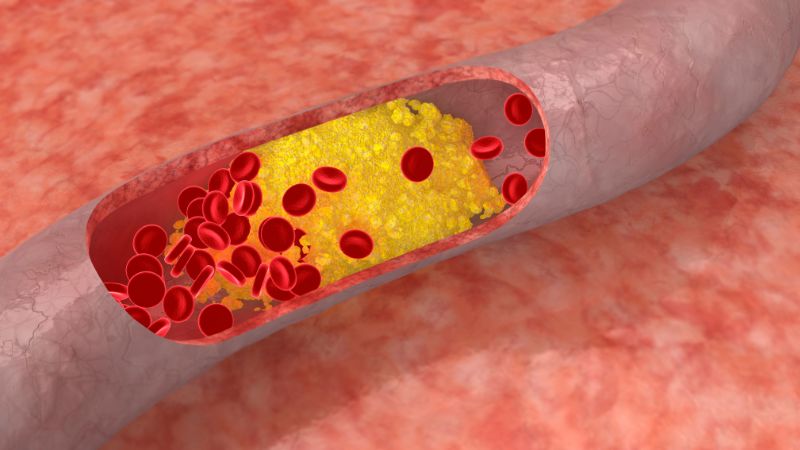 Giảm cholesterol xấu LDL