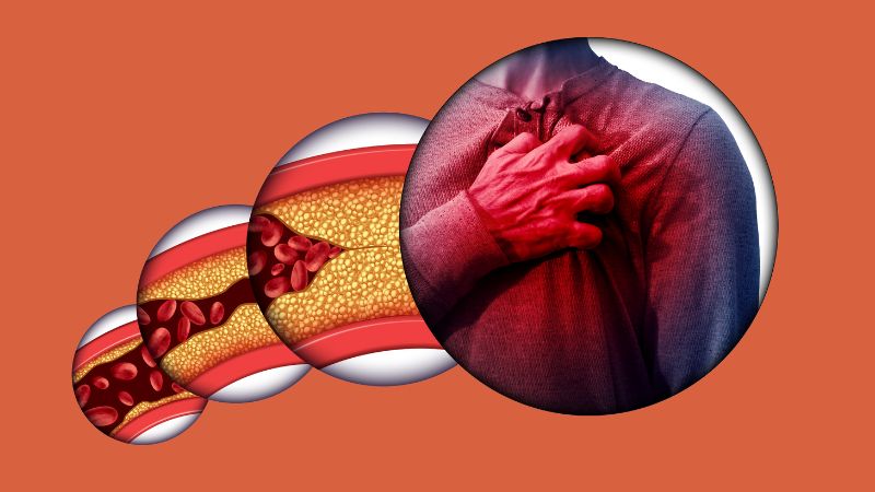 Giảm nguy cơ xơ vữa động mạch