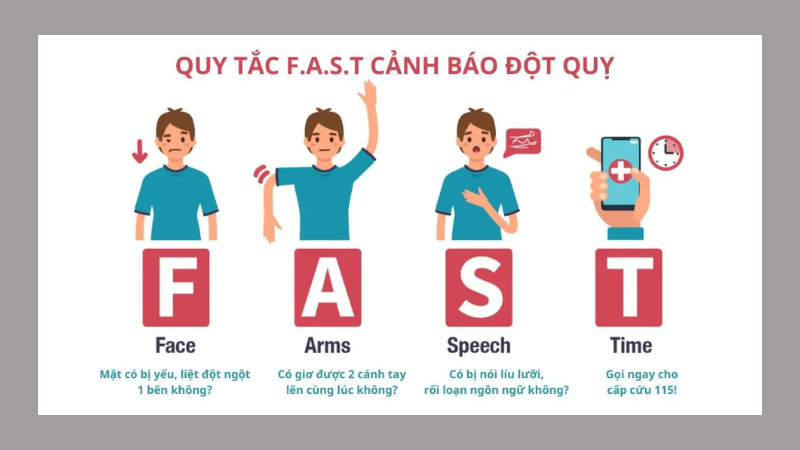 Quy tắc F.A.S.T dấu hiệu cảnh báo đột quỵ