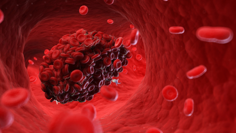 Policosanol giúp giảm hình thành cục máu đông và hỗ trợ phòng ngừa xơ vữa động mạch