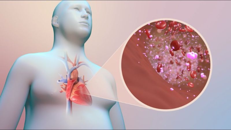 Bệnh tim mạch là nhóm các bệnh lý ảnh hưởng trực tiếp đến cấu trúc và chức năng tim