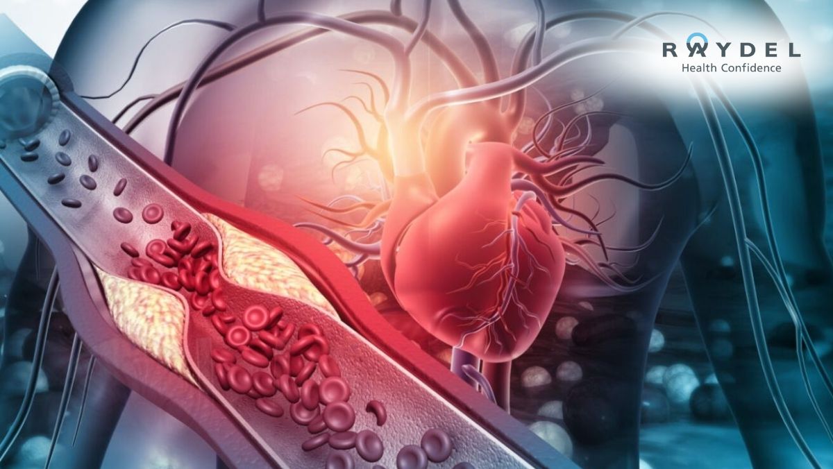 Bệnh tim mạch là gì? Dấu hiệu, cách điều trị và phòng ngừa