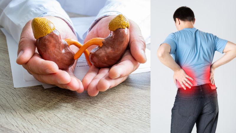 Nhóm bệnh nhân suy thận rất dễ bị máu nhiễm mỡ